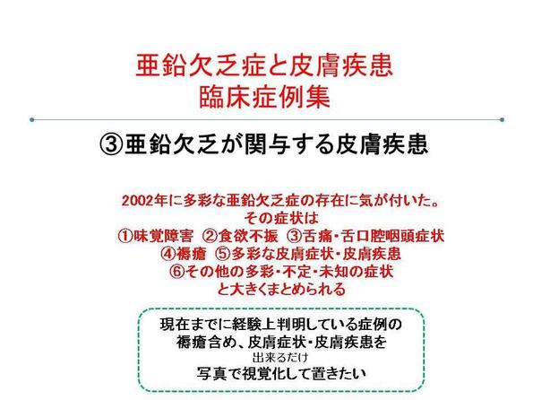 亜鉛は爪にどのような影響を与えるのでしょうか？